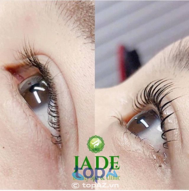 Viện Thẩm Mỹ JADE Beauty Spa & Clinic - Đẳng cấp làm đẹp chuẩn quốc tế