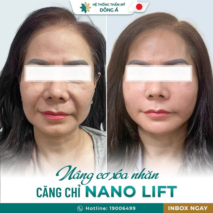 Thẩm Mỹ Viện Đông Á hình ảnh 1