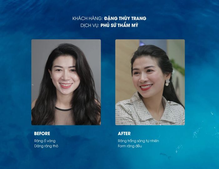 Hình ảnh thực tế Shinbi Dental - Không gian sang trọng đạt chuẩn Hàn Quốc