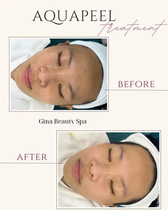 Không gian trị liệu đẳng cấp tại Gina Beauty Spa - Cầu Giấy
