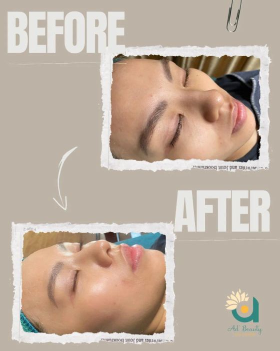 Hình ảnh quy trình trị liệu chuyên nghiệp tại Ad'Beauty Spa Center