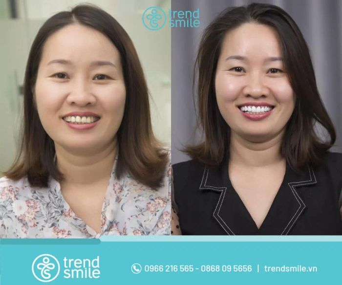 Hình ảnh thực tế tại Nha khoa Trend Smile - Không gian hiện đại đạt chuẩn quốc tế