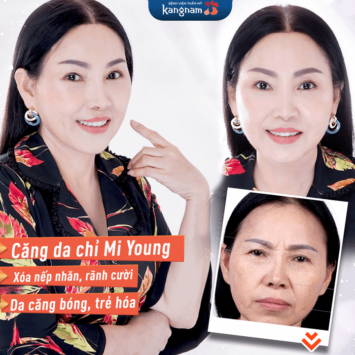 Bệnh viện thẩm mỹ Kangnam hình ảnh 2