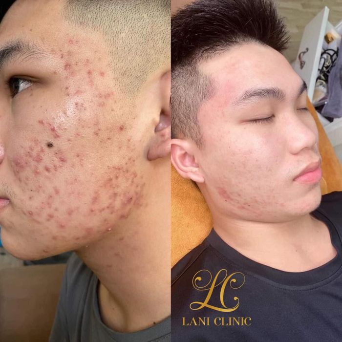 Không gian sang trọng đạt chuẩn 5 sao tại Lani Clinic - Beauty & Spa