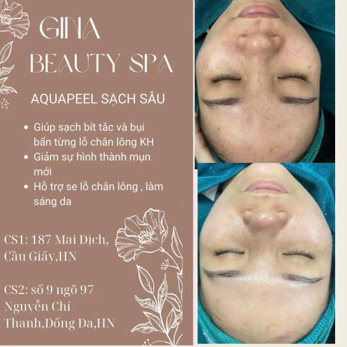 Hình ảnh quy trình trị liệu chuyên nghiệp tại Gina Beauty Spa