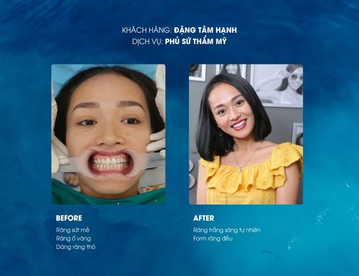 Hình ảnh phòng Lab hiện đại tại Shinbi Dental