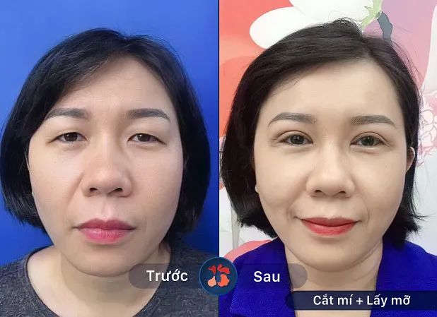 Thư viện hình ảnh Bệnh viện Kangnam - Cơ sở vật chất hiện đại bậc nhất