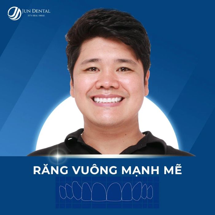 Hình ảnh phòng Lab hiện đại tại Nha khoa Jun Dental