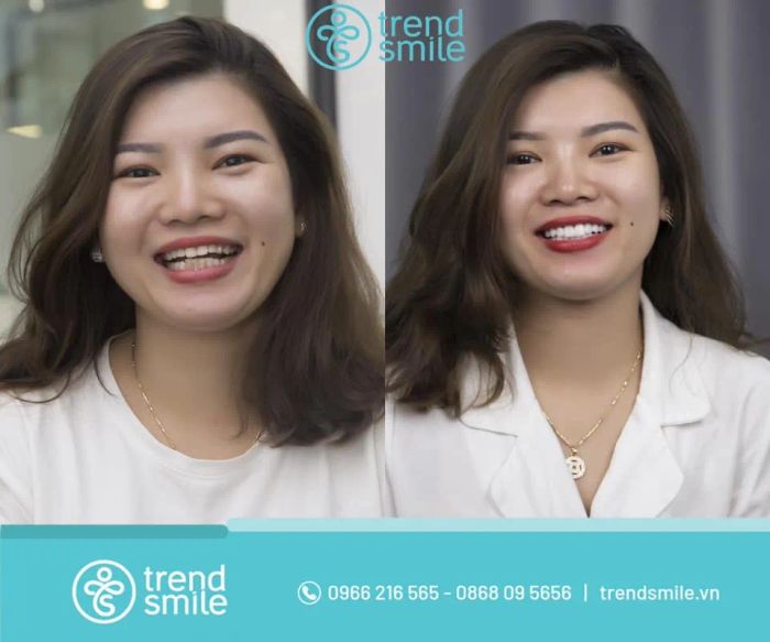 Hình ảnh Nha khoa Trend Smile - Không gian sang trọng chuẩn phong cách Hàn Quốc