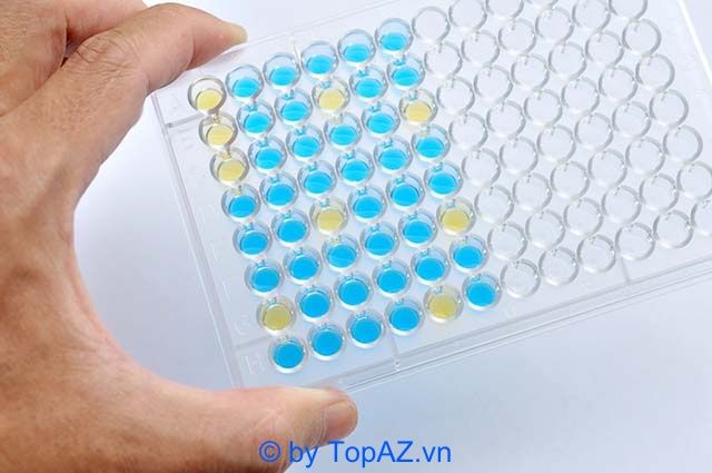 địa chỉ xét nghiệm giun đầu gai uy tín tại TP.HCM