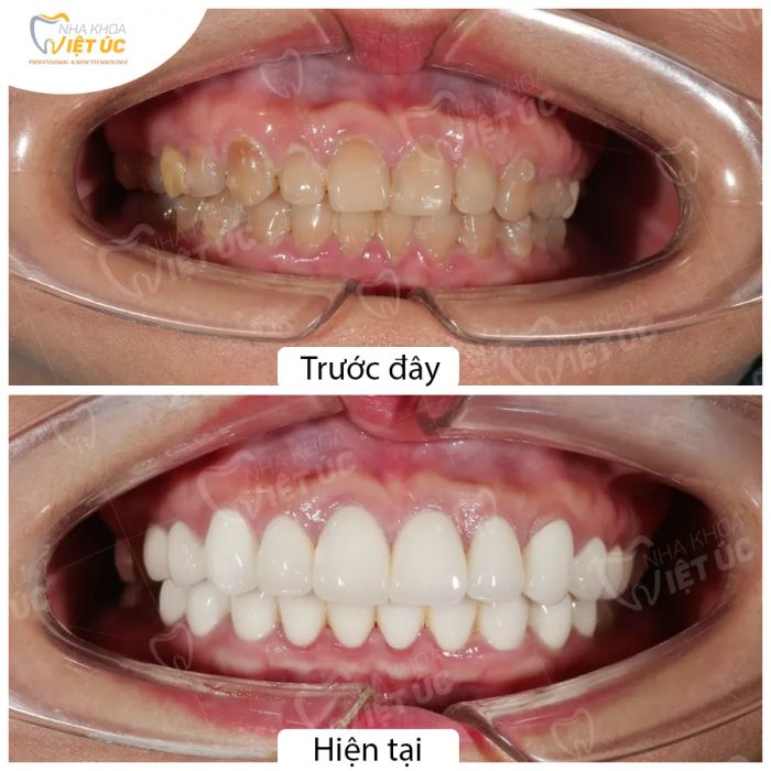 Hình ảnh phòng khám hiện đại tại Nha khoa Việt Úc - Tiêu chuẩn 5 sao quốc tế