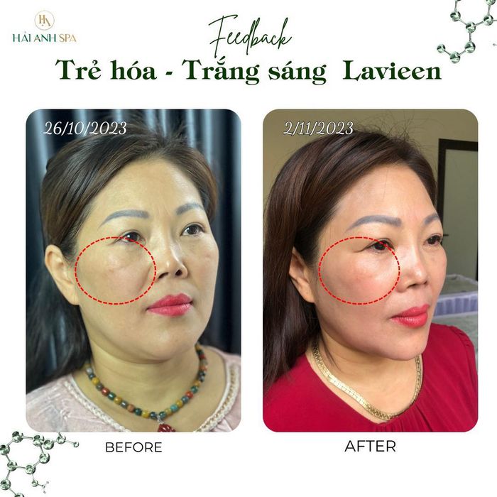 Hình ảnh không gian trị liệu đẳng cấp tại Hải Anh Spa - Thanh Xuân