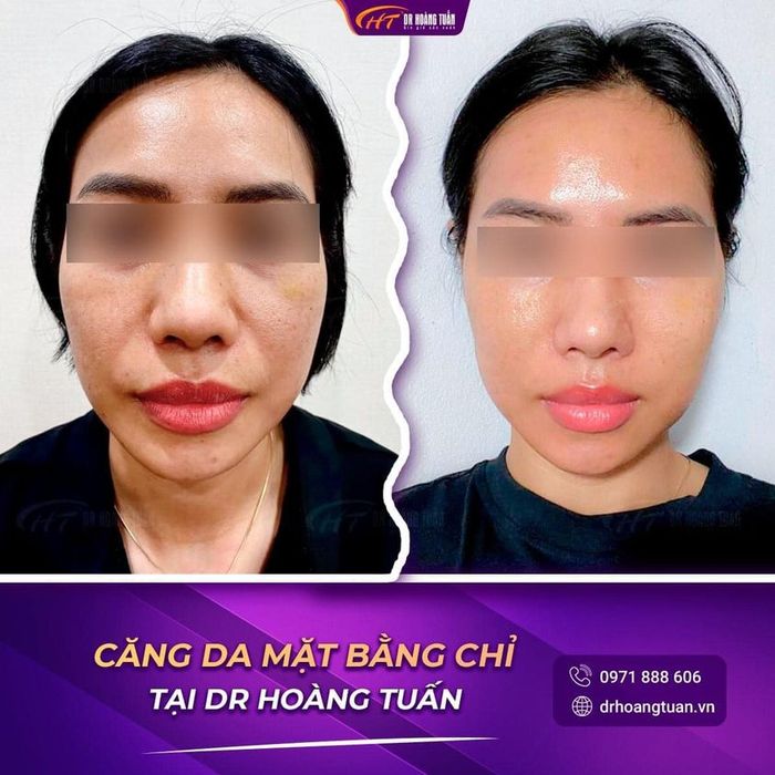 Viện Thẩm Mỹ Hoàng Tuấn hình ảnh 2