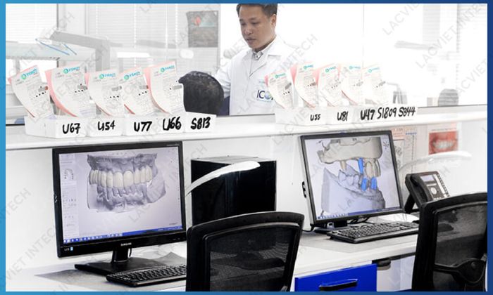 Hình ảnh thực tế Nha Khoa Lạc Việt Intech