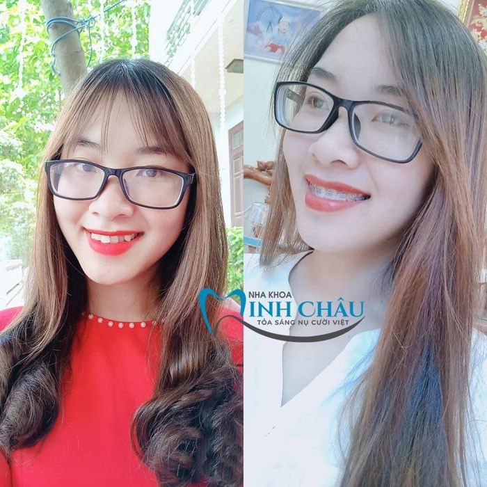 Nha Khoa Minh Châu - Dịch vụ nha khoa hàng đầu với công nghệ tiên tiến