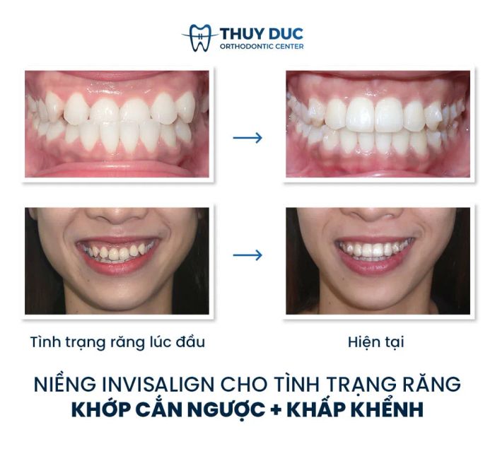 Hình ảnh đội ngũ bác sĩ và ca điều trị thành công tại Nha khoa Thúy Đức