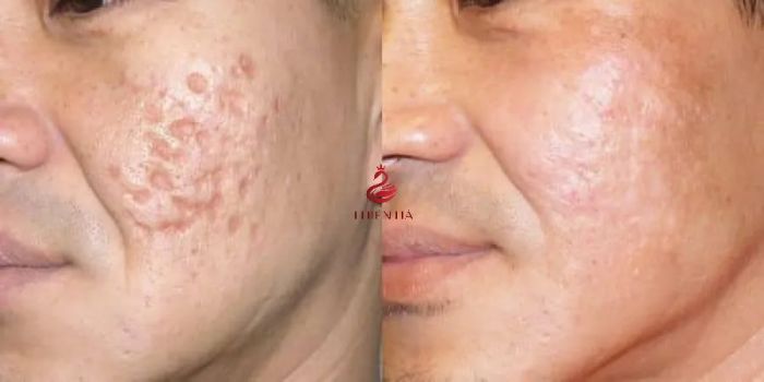 Không gian sang trọng chuẩn 5 sao tại Thiên Hà
