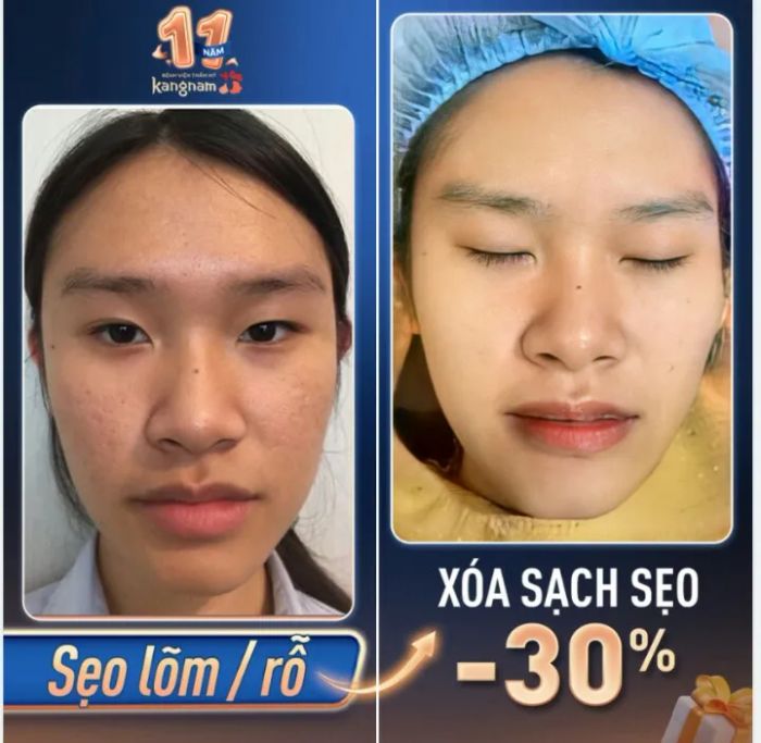 Không gian sang trọng đạt chuẩn 5 sao tại Kangnam