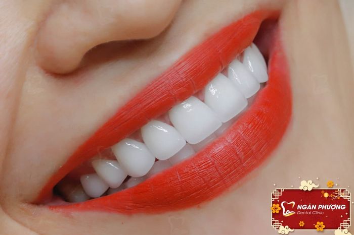 Nha Khoa Ngân Phượng - Gợi ý hoàn hảo cho một nụ cười tự tin và khỏe mạnh