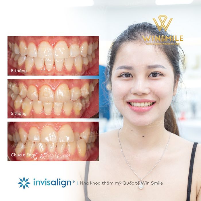 Không gian sang trọng đạt chuẩn quốc tế tại Win Smile
