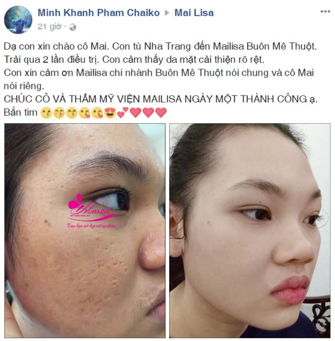 Không gian sang trọng đạt chuẩn 5 sao tại Mailisa