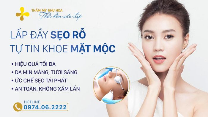 Hình ảnh điều trị sẹo rỗ tại Thẩm Mỹ Như Hoa