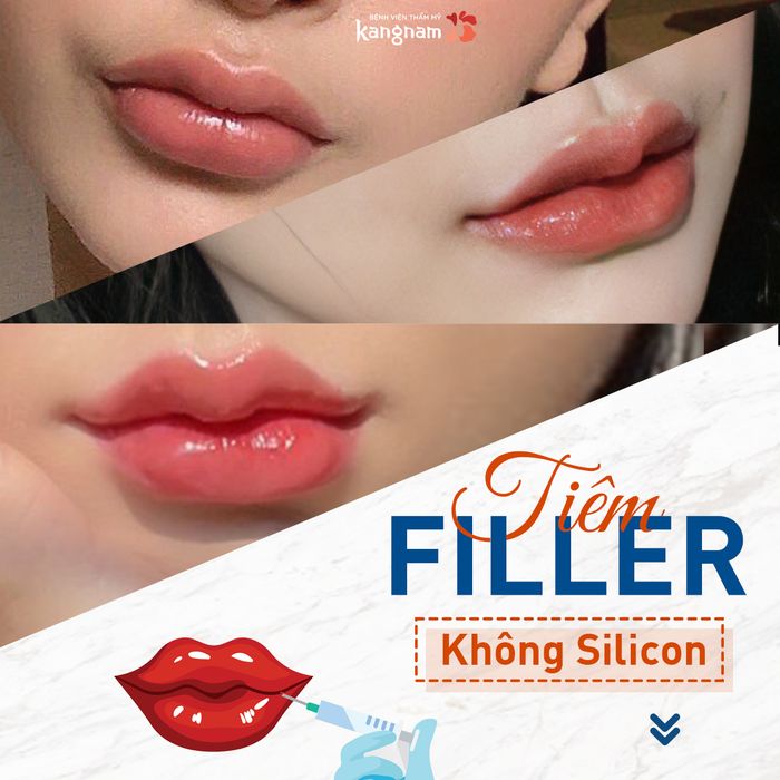 Bệnh viện thẩm mỹ Kangnam - Hình ảnh không gian sang trọng đạt chuẩn 5 sao