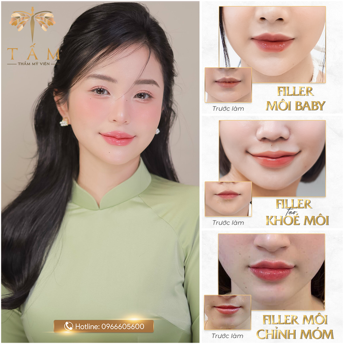 Hình ảnh cơ sở vật chất hiện đại tại Thẩm Mỹ Viện Tấm