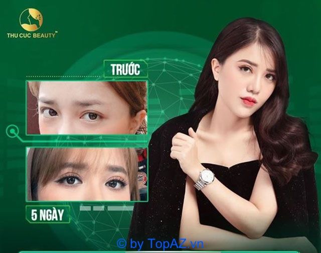 Mở rộng góc mắt ở đâu đẹp tại TP.HCM?