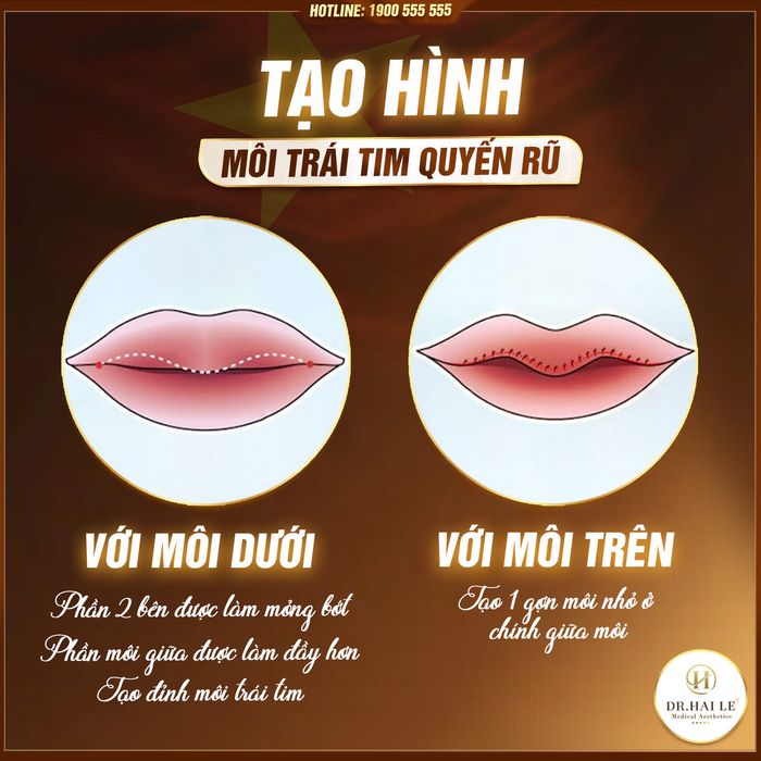 Viện Thẩm Mỹ Y Khoa Dr.Hải Lê - Hình ảnh minh họa quy trình tiêm môi chuẩn y khoa