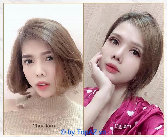 Mở rộng góc mắt ở đâu đẹp tại TP.HCM?