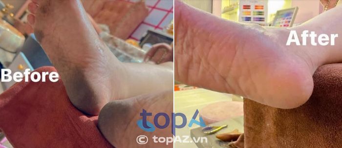 Angel Hạnh Phúc - Nail Spa Beauty Bình Tân - Điểm hẹn vàng cho đôi chân đẹp