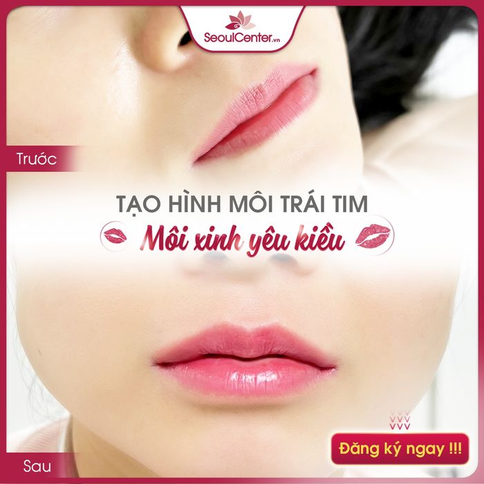 Bệnh Viện Thẩm Mỹ Quốc Tế Seoul Center - Hình ảnh ấn tượng về không gian sang trọng