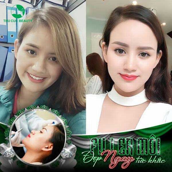Hình ảnh Bệnh viện Thẩm mỹ Thu Cúc - Nơi gửi trọn niềm tin làm đẹp