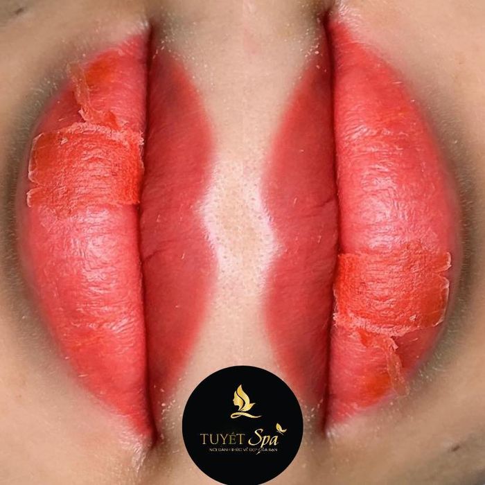 Ảnh minh hoạ của Spa Tuyết Băng 2