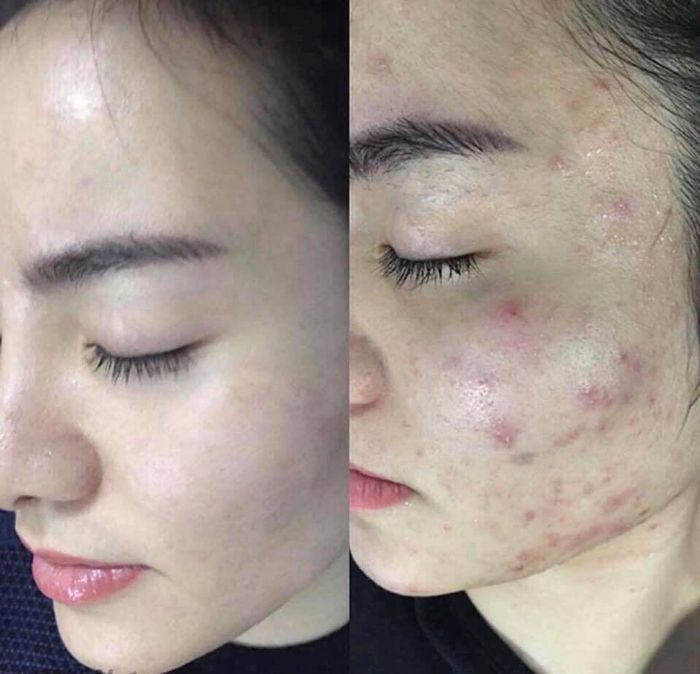 Ellen Spa – Khoảnh khắc lưu giữ vẻ đẹp thanh xuân (ảnh 2)