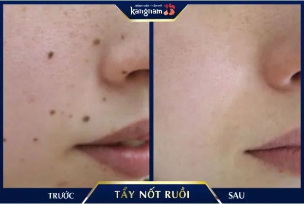 Hình ảnh không gian sang trọng tại Bệnh viện thẩm mỹ Kangnam