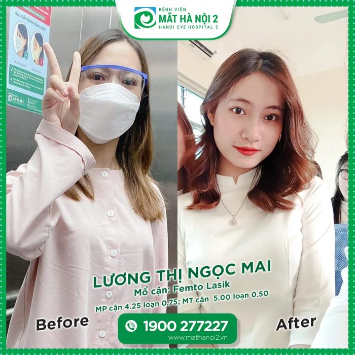 Hình ảnh phòng phẫu thuật hiện đại tại Bệnh Viện Mắt Hà Nội 2