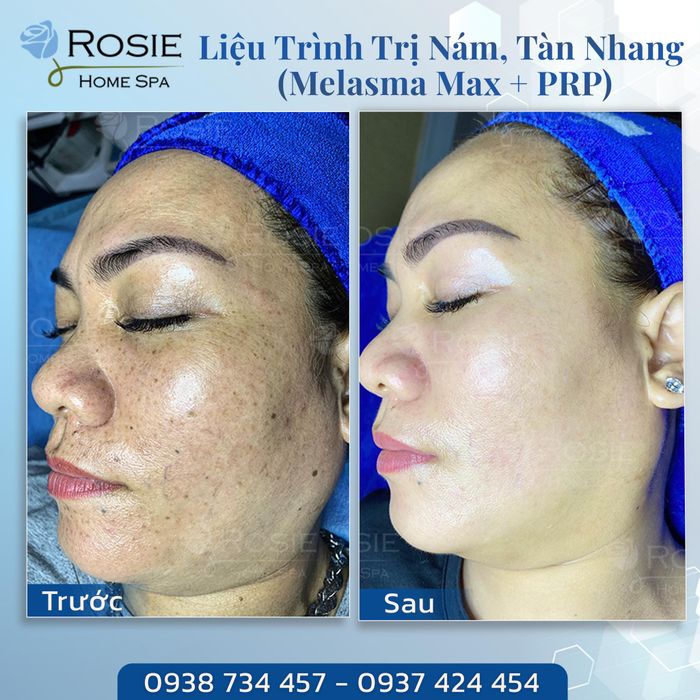Khoảnh khắc làm đẹp tại Rosie Home Spa – Yêu bản thân mỗi ngày