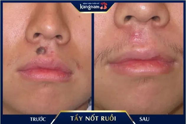 Hình ảnh cơ sở vật chất hiện đại tại Bệnh viện thẩm mỹ Kangnam