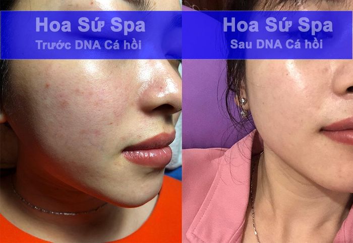 Không gian thư giãn tại Hoa Sứ Spa - Hình ảnh 2