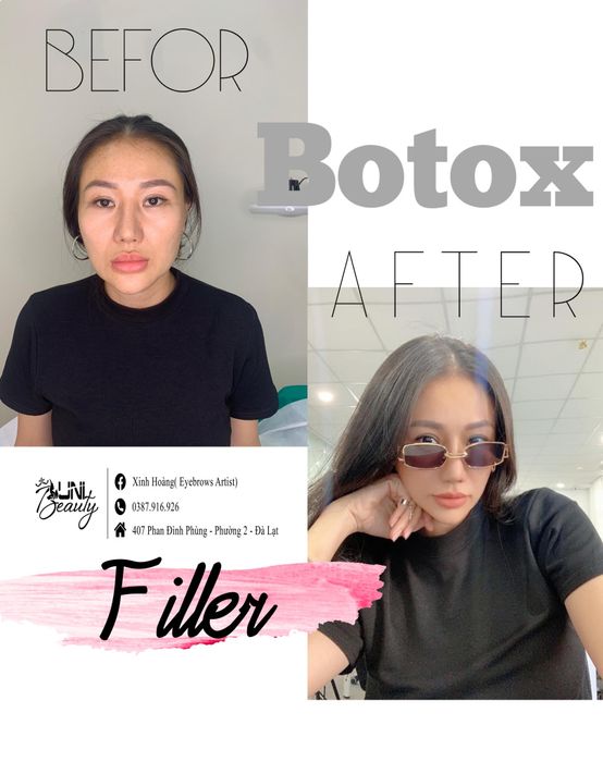 Phòng điều trị tiêu chuẩn tại UNI Beauty