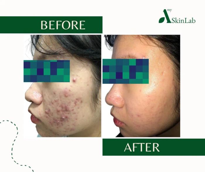 Amy SkinLab - Không gian trị liệu chuẩn phòng khám da liễu