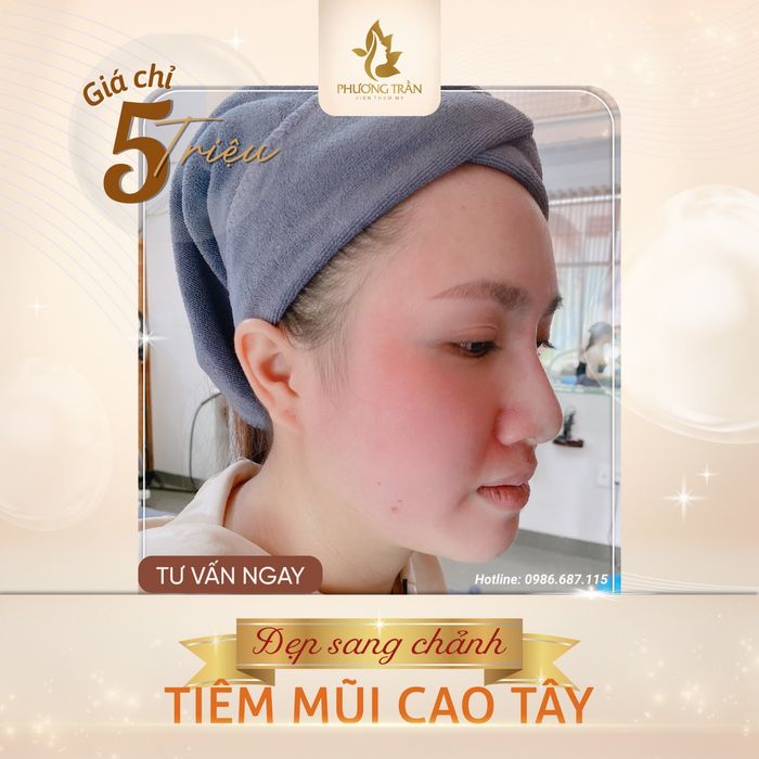 Phòng điều trị cao cấp tại Viện Thẩm Mỹ Phương Trần