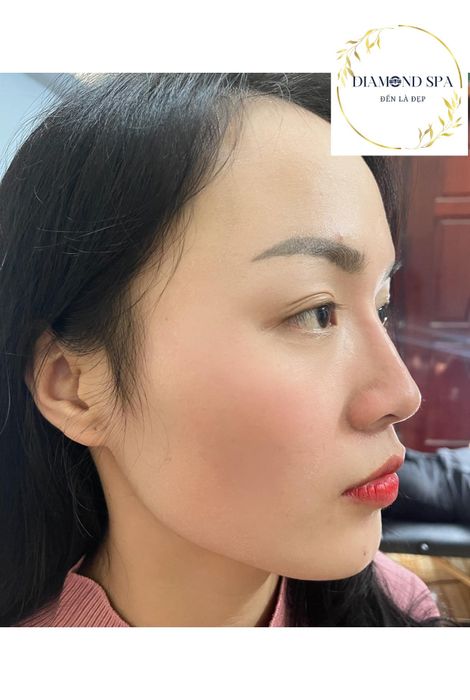 Phòng điều trị tiêu chuẩn tại Diamond Spa & Clinic
