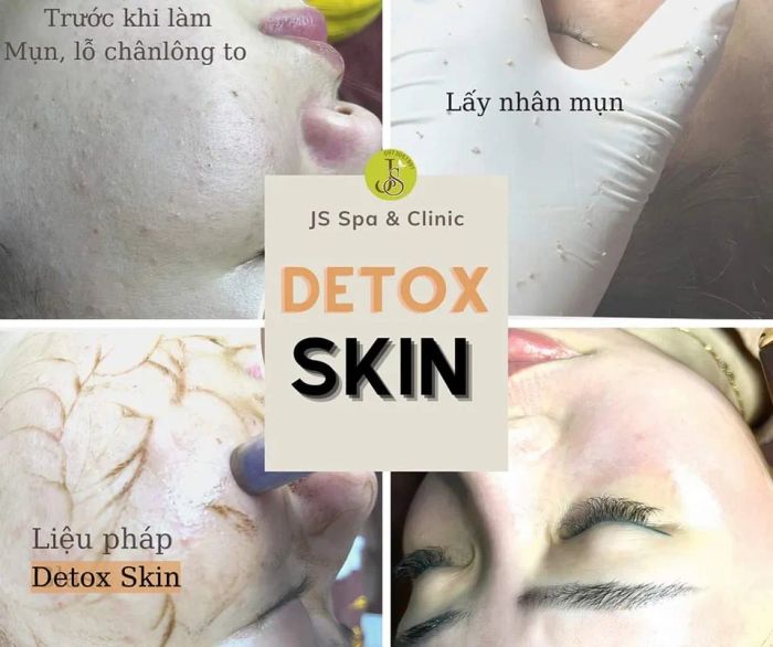 JS Spa & Clinic - Không gian trị liệu sang trọng đạt chuẩn quốc tế