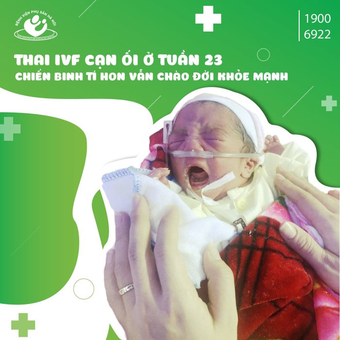 Khám phá không gian hiện đại và dịch vụ chất lượng tại Bệnh viện Phụ Sản Hà Nội qua góc nhìn ảnh.