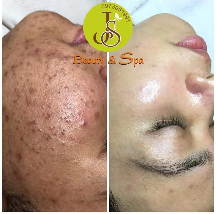 JS Spa & Clinic - Không gian sang trọng đạt chuẩn 5 sao
