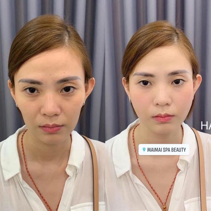 Hình ảnh thực tế về cơ sở vật chất Mai Mai Beauty Spa & Clinic