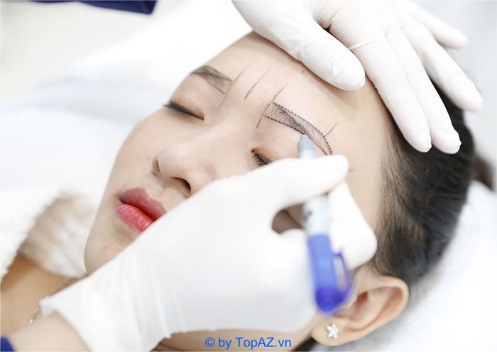 Thẩm mỹ viện Ngọc Dung sử dụng thiết bị phun siêu nhỏ, giúp hạn chế tổn thương da, mang đến hiệu quả tối ưu cho khách hàng mà không gây đau đớn hay khó chịu.